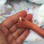 prematuridade neonatal