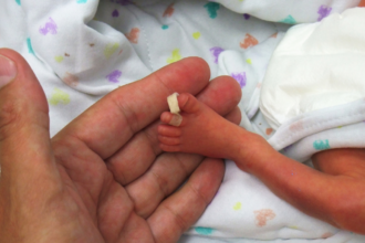 prematuridade neonatal