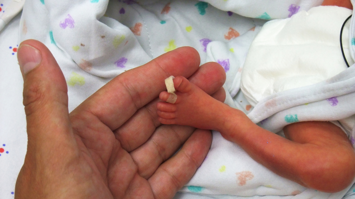 prematuridade neonatal